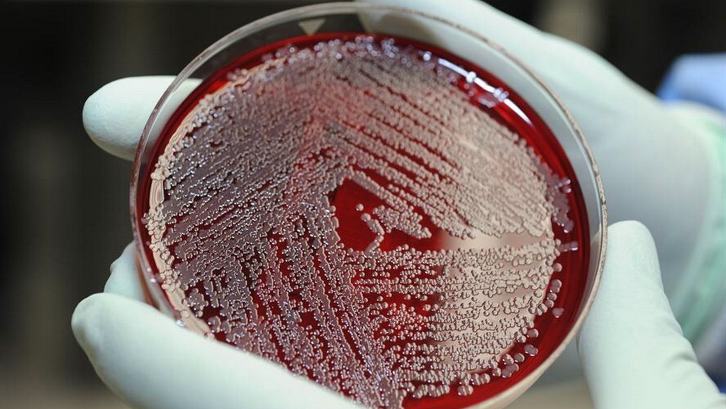 Mikrobiyoloji Testleri - Pseudomonas Aeruginosa (ISO 22717)